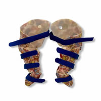 Bilateral KAFOs (knee ankle foot orthosis) for an Old English Bulldog suffering from joint instability and hyper extension of both knees.